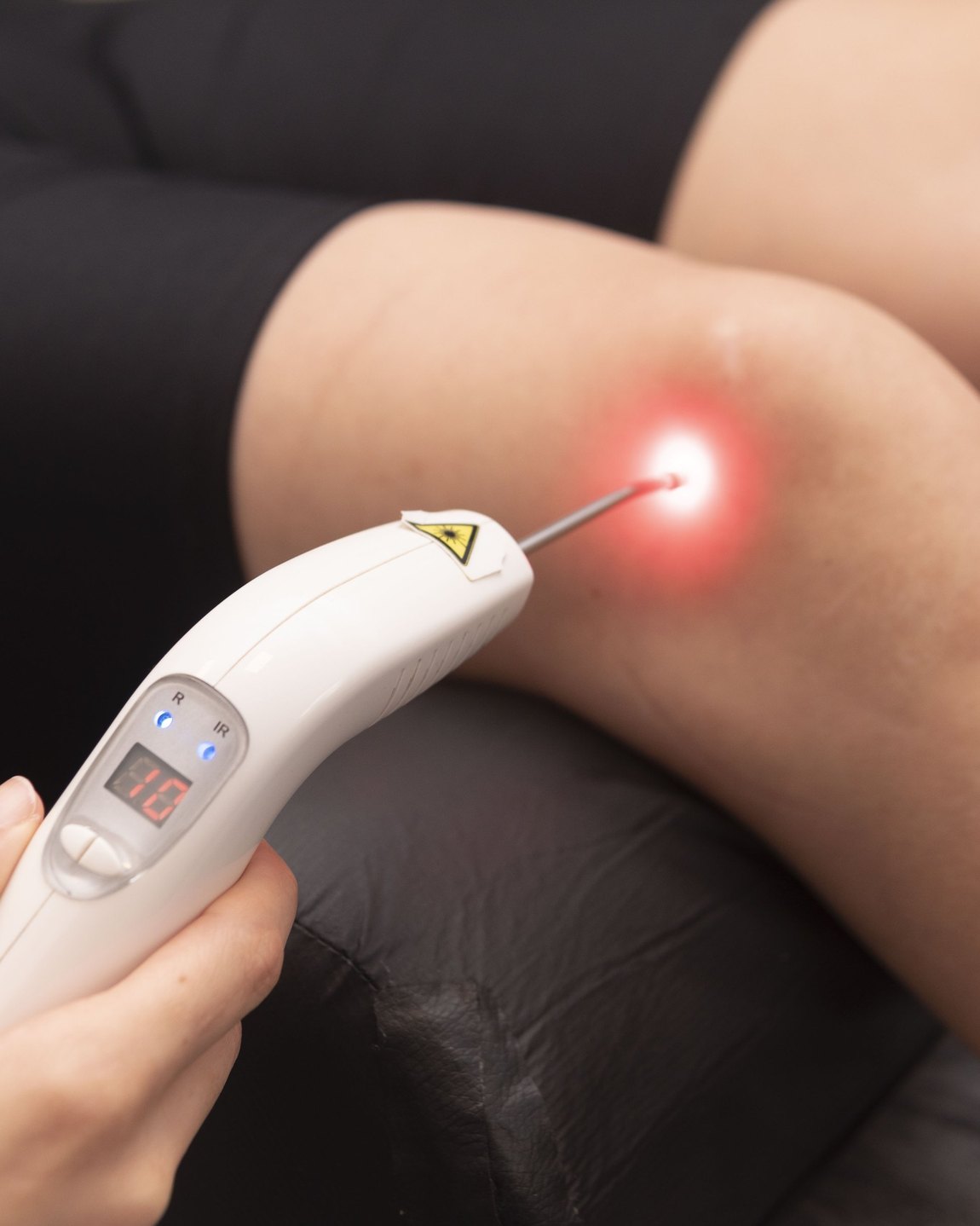 Aplicação de laser terapêutico no joelho durante uma sessão de fisioterapia na Clínica Drago